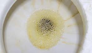 Foamy Urine: Why Your Urine Foams, and When to Worry